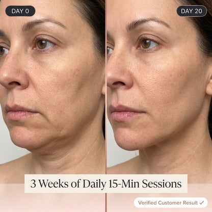 EMS V-Face Lifting Device